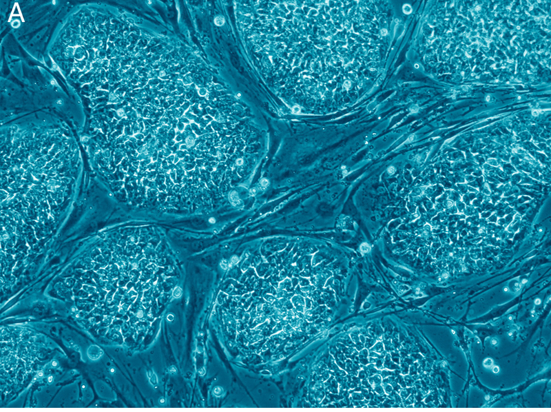 Celulele stem embrionare