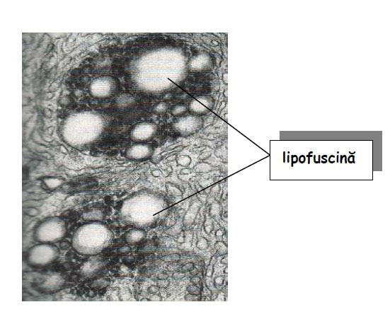 Depozite de pigment lipofuscinic în glanda corticosuprarenală umană
