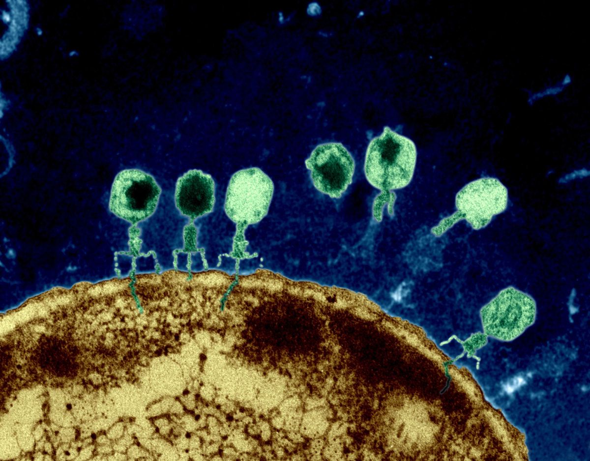 Bacteriofag la microscop electronic