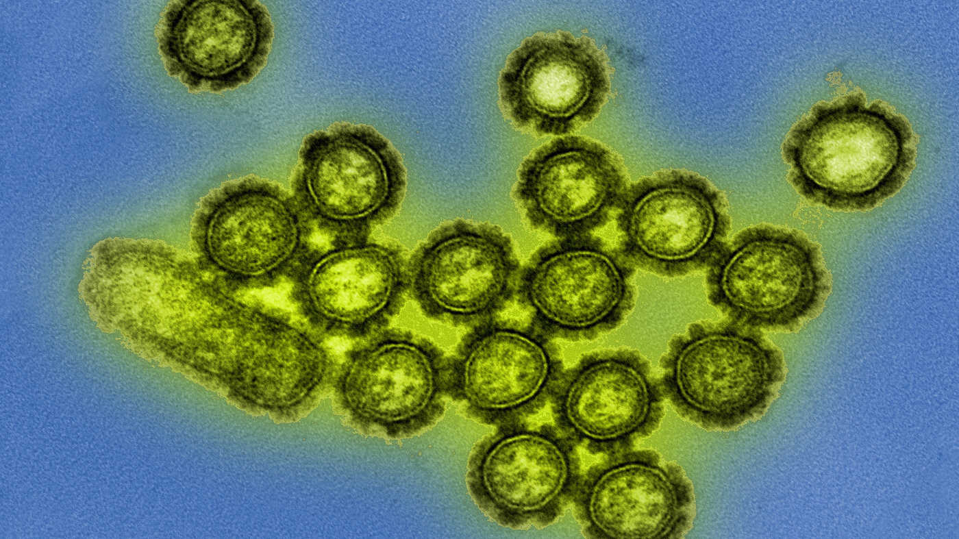 Virusul gripal h1n1